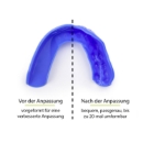 Picture of SISU Mouthguard Tether